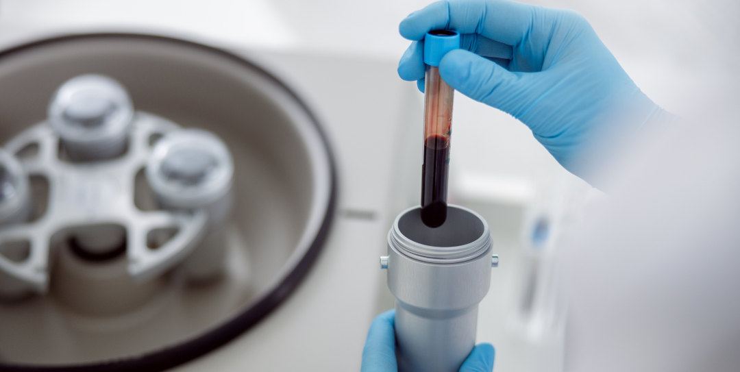 titer testing